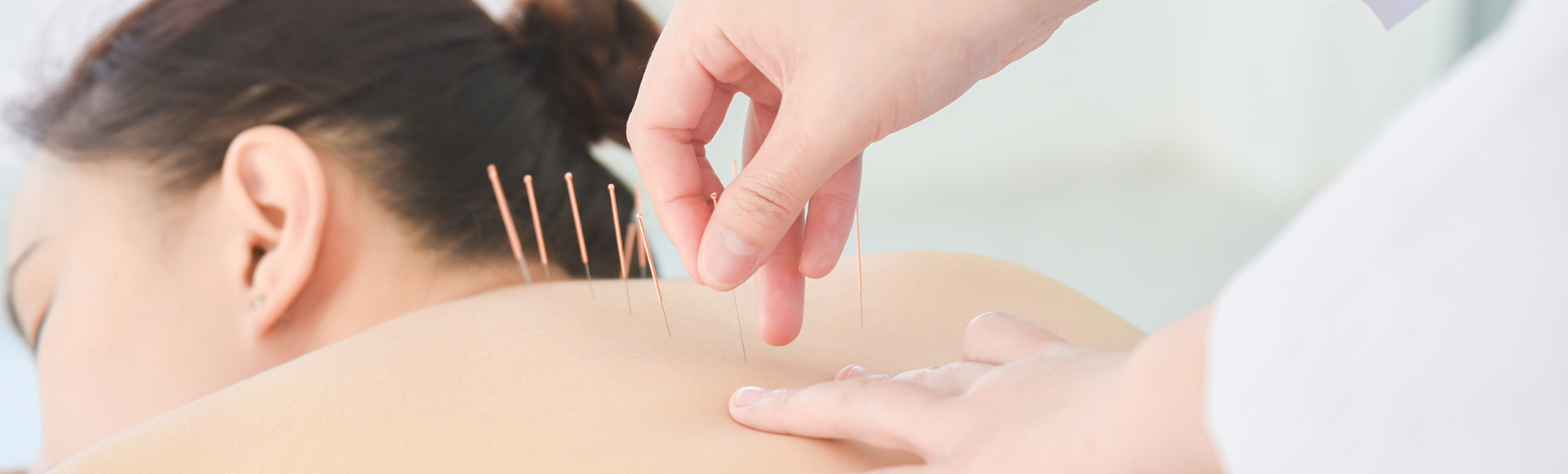 bounce-back-health-wellbeing-gawler-munno-para-acupuncture